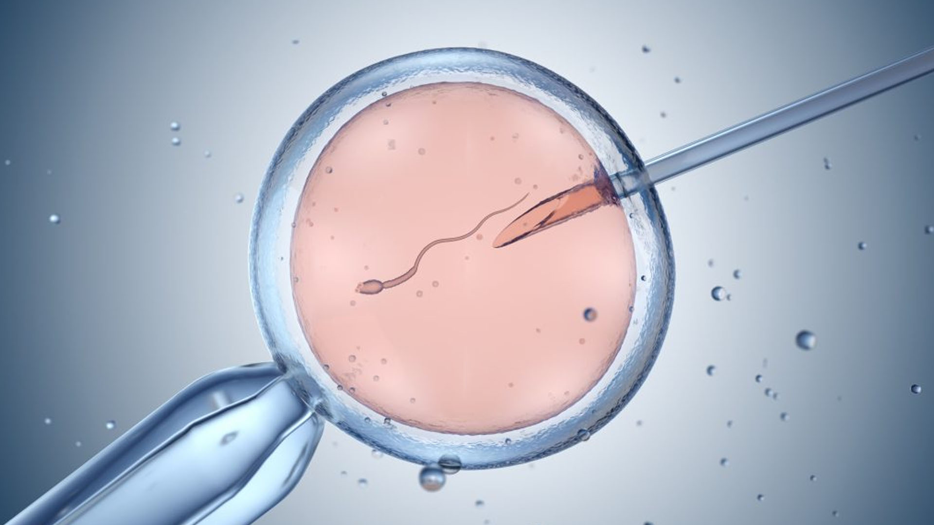 in vitro fertilization(ivf)
