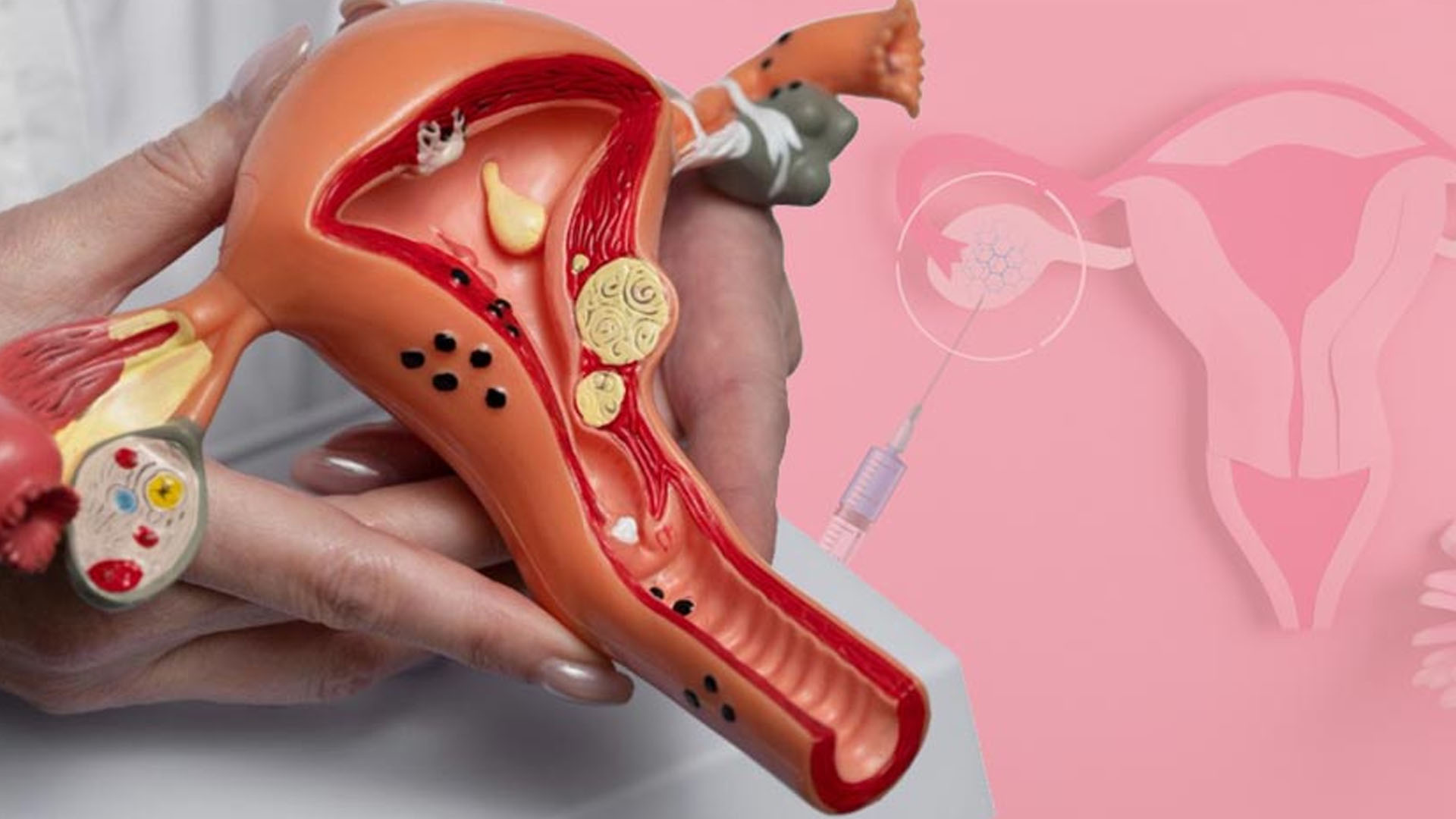 ovarian rejuvenation