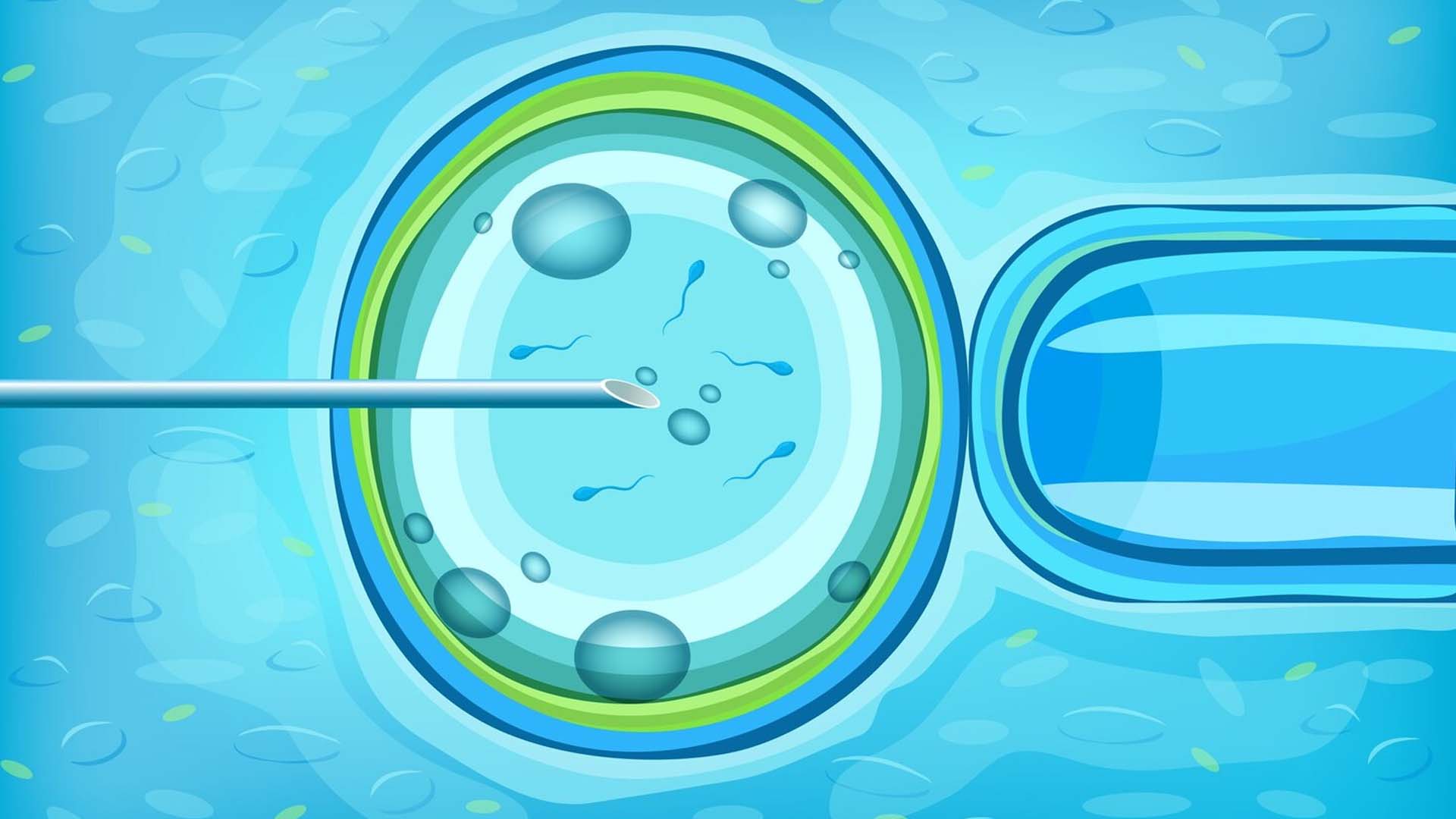 Male Infertility Solutions intracytoplasmic sperm injection (icsi)
